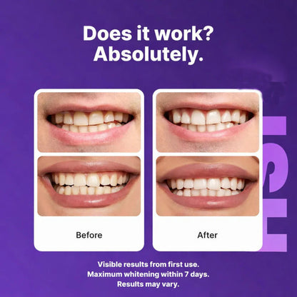 👉 Whiter Teeth Without Expensive Dental Visits