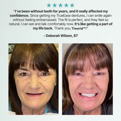 Custom-Fit Full Functional Dentures Make you more confident