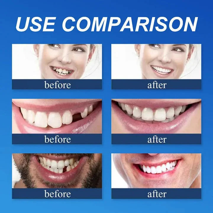 Custom-Fit Full Functional Dentures Make you more confident