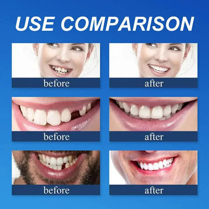 Custom-Fit Full Functional Dentures Make you more confident