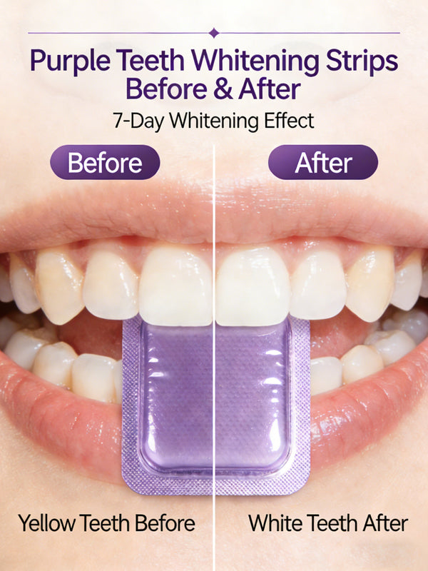 👉 Whiter Teeth Without Expensive Dental Visits