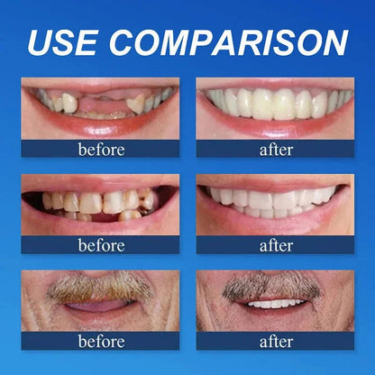 Custom-Fit Full Functional Dentures Make you more confident